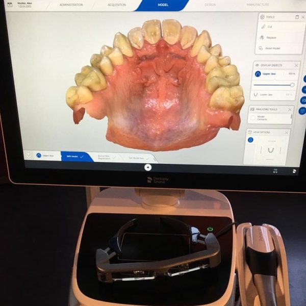 CEREC Primescan AC Intraoral scanner - Image 3